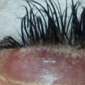 Who is not suitable for eyelash extensions?